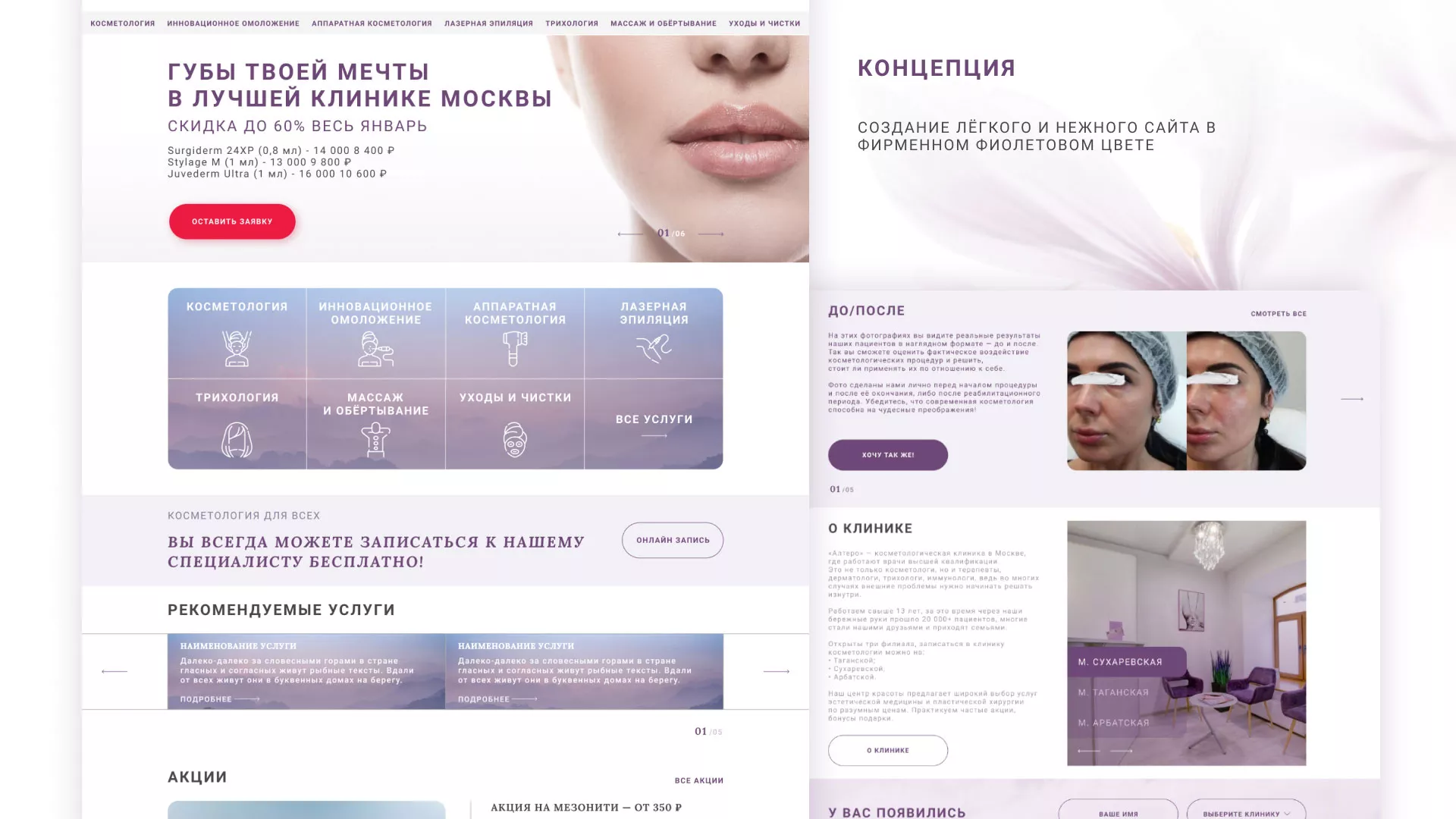 Создание сайта сети клиник эстетической косметологии «Алтеро» в Хотьково